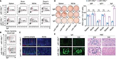 Epigenetic Modulation of Class-Switch DNA Recombination to IgA by miR-146a Through Downregulation of Smad2, Smad3 and Smad4